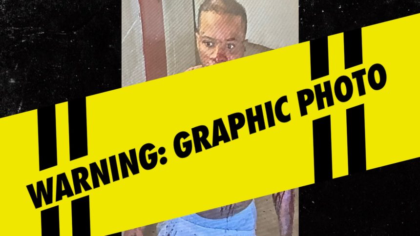 Tory Lanez, Victimă a unui Atac Violent în Închisoare: Detalii Șocante despre Lupta Sângeroasă 1 tory lanez seen being stabbed repeatedly in brutal prison fight on video 68374b2be30c3