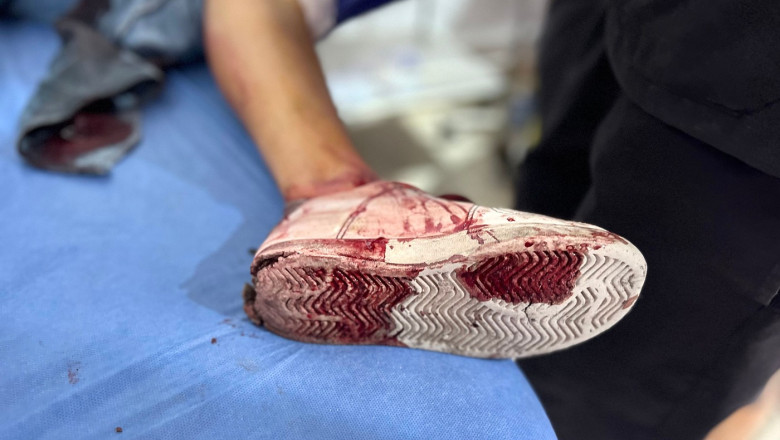 Forțele armate israeliene cercetează acuzații de crime de război în Gaza, în urma unor atacuri deliberate asupra civililor palestinieni. 1 armata israeliana ancheteaza posibile crime de razboi comise in gaza soldatii ar fi tras intentionat asupra civililor palestinieni 685fa37ac233f