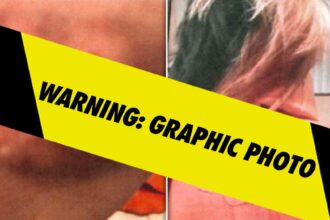 bryana bongolans alleged injury photos from diddy balcony incident filed as evidence 6844a1d0f34b1