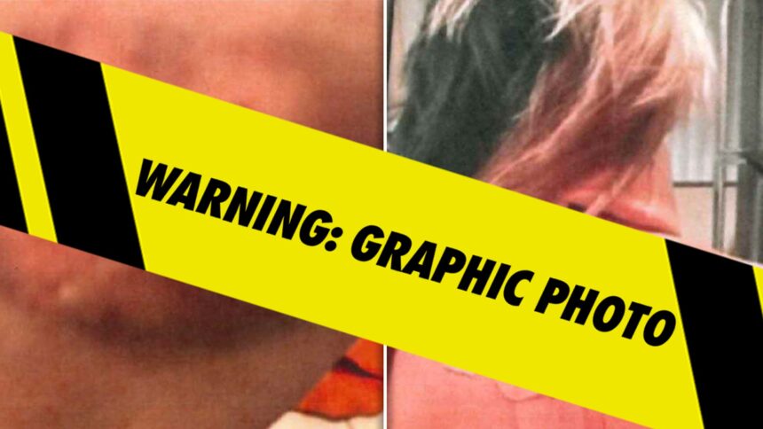 Imaginile presupuselor răni ale Bryanei Bongolan din incidentul de pe balconul lui Diddy prezentate ca dovezi 1 bryana bongolans alleged injury photos from diddy balcony incident filed as evidence 6844a1d0f34b1