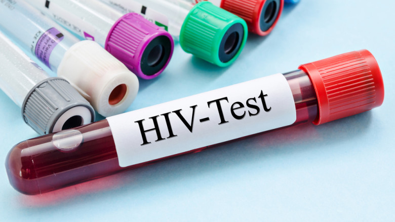 Cercetătorii din Australia, entuziasmați de rezultatele unui tratament inovator împotriva HIV. O descoperire promițătoare ce ar putea elimina virusul 1 cercetatorii australieni uluiti de efectele unui nou tratament contra hiv descoperirea care ar putea duce la eradicarea virusului 684511d2f3410