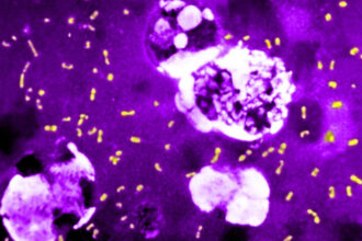 cum a evoluat cea mai letala bacterie din toate timpurile ca sa continue sa omoare milioane de oameni si sa supravietuiasca pana astazi 683e815e48d95