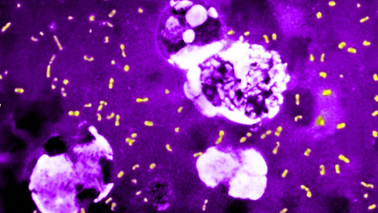 Dezvăluiri despre ascensiunea unei bacterii temute: cum a reușit să provoace milioane de victime și să dăinuie până în prezent 1 cum a evoluat cea mai letala bacterie din toate timpurile ca sa continue sa omoare milioane de oameni si sa supravietuiasca pana astazi 683e815e48d95