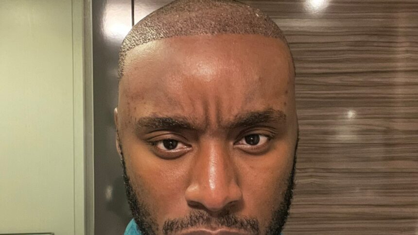 Anunțul oficial al cauzei de deces a lui P2istheName, dezvăluit de medicul legist din L.A. County 1 p2isthenames cause of death released by l a county medical examiner 6848b4c96e775