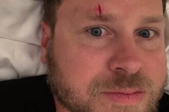 spencer pratt horrifies fans with bloody forehead gash as he calmly asks them for treatment tips 6860578e6392a