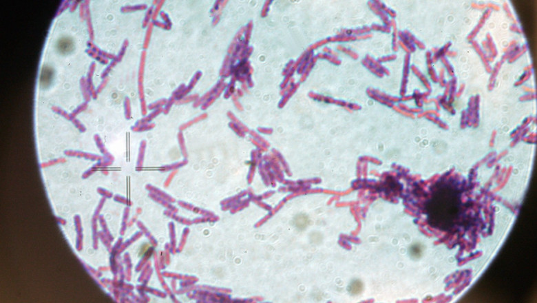 Două cazuri de antrax descoperite în România. 1 doua cazuri de antrax confirmate in romania 6870158b35ba0