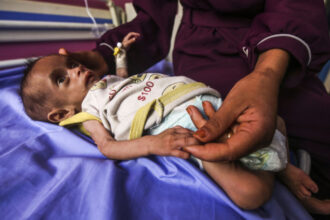 galerie foto infometare in masa numarul copiilor subnutriti din gaza cu varste sub 5 ani s a triplat in ultimele doua saptamani 6883ef2f97ae5