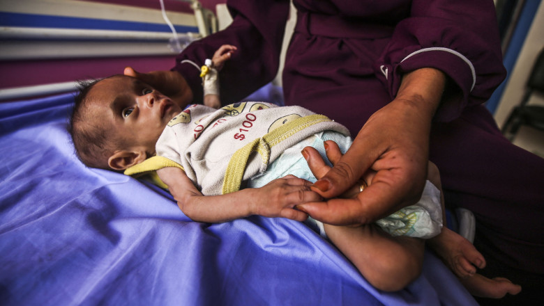 „Criza foametei: Numărul copiilor sub 5 ani afectați de subnutriție în Gaza s-a triplat în ultimele două săptămâni.” 1 galerie foto infometare in masa numarul copiilor subnutriti din gaza cu varste sub 5 ani s a triplat in ultimele doua saptamani 6883ef2f97ae5