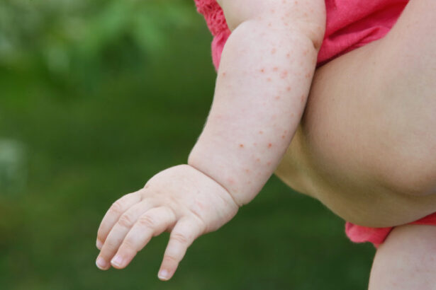 sua se confrunta cu cea mai grava epidemie de rujeola din secolul xxi secretarul de stat robert kennedy jr acuzat ca o alimenteaza 686c12fae65db