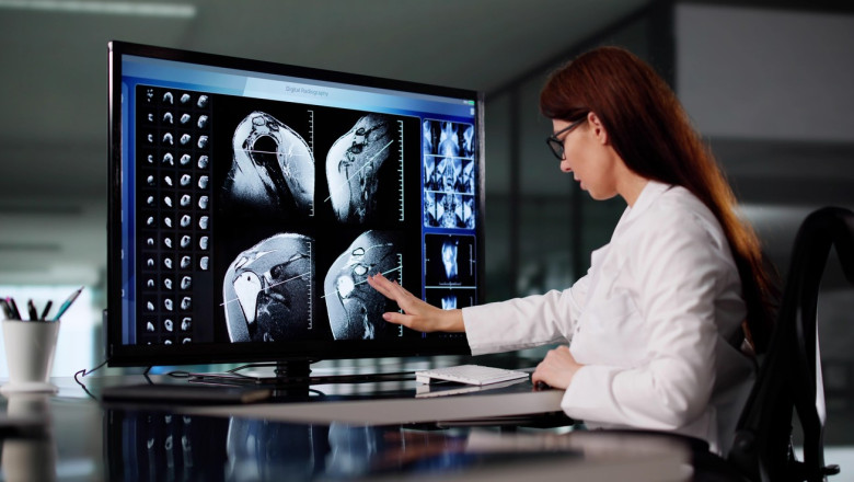 Un proiect revoluționar în imagistica medicală promite să transforme metodele de diagnosticare a bolilor. Ce dezvăluie imaginile despre utilizarea alcoolului? 1 un proiect urias de imagistica medicala va schimba felul in care bolile sunt depistate ce arata imaginile despre consumul de alcool 687f10c8e1e4d