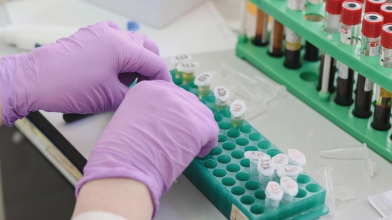 Avertisment sanitar: a fost identificat primul caz uman infectat cu parazitul devastator al țesuturilor 1 alerta medicala primul caz uman confirmat cu parazitul care distruge tesuturile 68acc6d8a5024