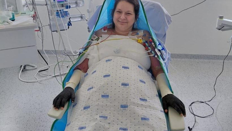 Care este evoluția Laviniei, pacienta cu arsuri transferată în Belgia de la Floreasca? Mesajul surorii sale: „Totul rămâne neclar.” 1 care este starea laviniei pacienta cu arsuri infectata la floreasca si transferata in belgia anuntul surorii sale ramane un mister 689f6fd09fa48