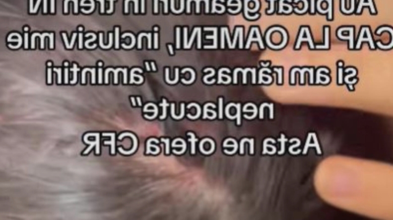 Momente de panică într-un tren românesc: o mamă și fiica ei de 12 ani au suferit răni după ce geamurile au explodat în mișcare 1 scene socante intr un tren din romania o femeie si o copila de 12 ani au fost ranite dupa ce mai multe geamuri s au spart in mers 68a45e84bff6c