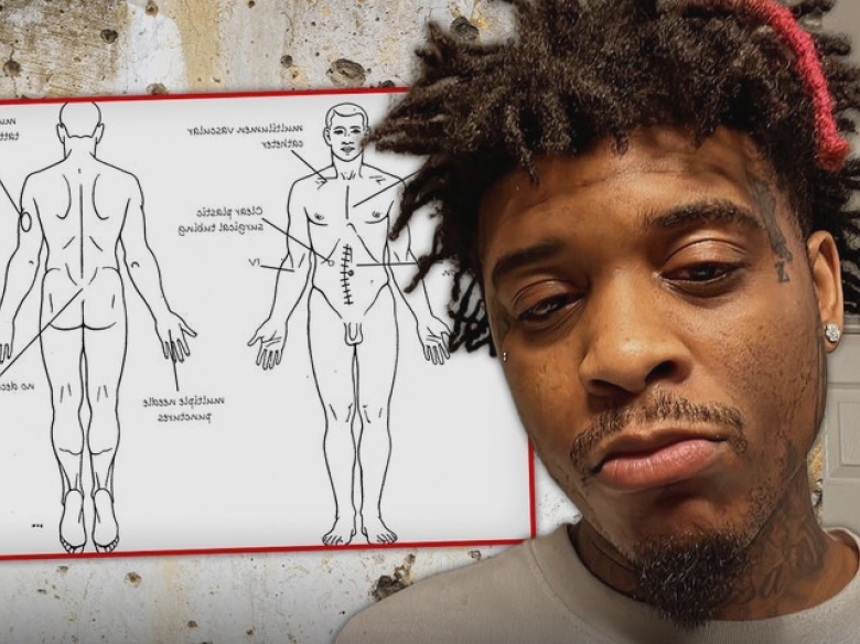 Autopsia lui T-Hood dezvăluie că rapperul a fost împușcat de cel puțin o dată în spate 1 t hood autopsy confirms rapper was shot at least once in the back 68a5ffbbb4523