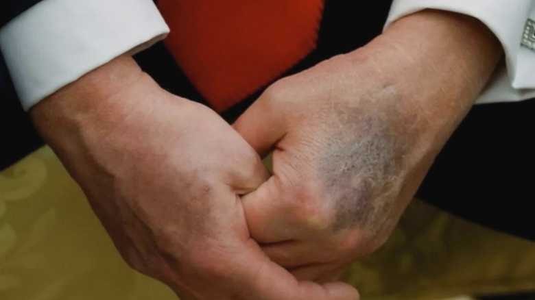 Speculațiile privind dispariția lui Donald Trump tulbură mediul online. Casa Albă păstrează tăcerea, în timp ce J.D. Vance lansează declarații surprinzătoare 1 zvonuri despre moartea lui donald trump agita retelele sociale casa alba nu comenteaza iar j d vance face afirmatii stranii 68b34d3b6f79b