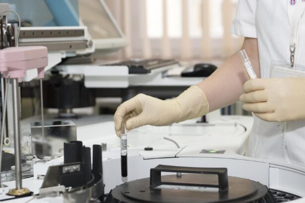 sapte focare de hepatita a confirmate intr un judet din romania aproape 150 de imbolnaviri si sute de persoane monitorizate 68dbc46e71dc5