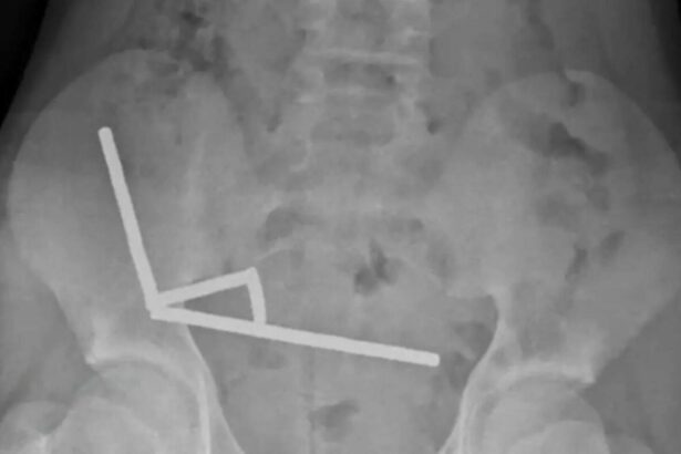 caz socant un baiat de 13 ani operat de urgenta dupa ce a inghitit aproape 200 de magneti 68fd02af4f714