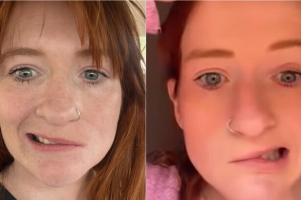 durerea unei tinere mame i a paralizat jumatate de fata dupa ce a consumat o bautura banala viata mea s a schimbat complet 68e814e193707