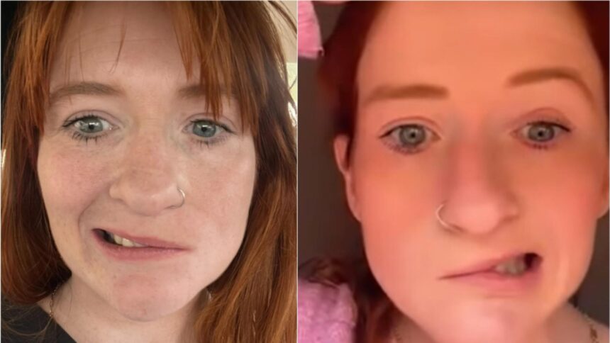 Încercarea cruntă a unei tinere mame: o băutură obișnuită i-a afectat grav fața, schimbându-i radical destinul 1 durerea unei tinere mame i a paralizat jumatate de fata dupa ce a consumat o bautura banala viata mea s a schimbat complet 68e814e193707