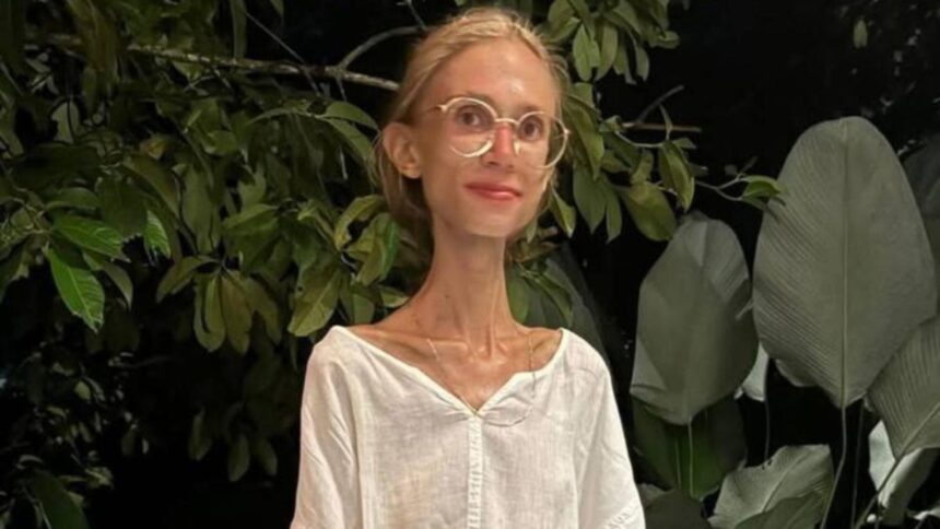 O tânără din Polonia își pierde viața după o dietă drastică formată exclusiv din fructe crude, cântărind doar 22 de kilograme 1 tanara poloneza moarta dupa o dieta extrema bazata doar pe fructe crude avea doar 22 de kilograme 68e9389885898