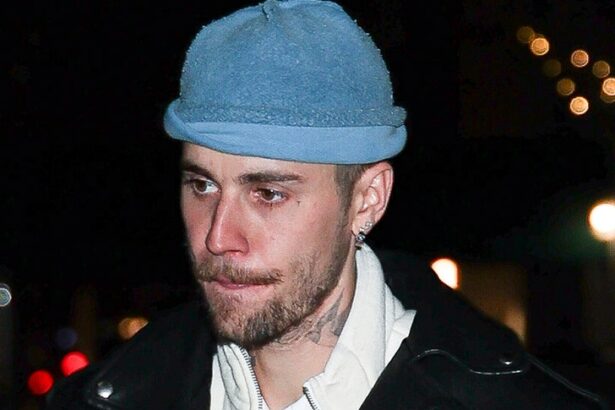 justin bieber hurts ribs in electric skateboard fail 691a689112a28