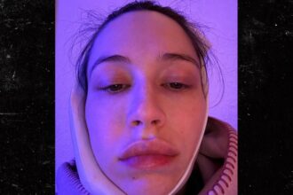 elsie hewitt had surgery to get wisdom tooth removed day after giving birth 694592341fa75