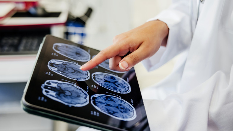 Legea privind a doua opinie medicală, adoptată în Parlament 1 camera deputatilor a adoptat legea privind dreptul pacientilor la a doua opinie medicala platita de stat 698c74ee0f645