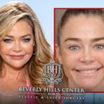 denise richards before and after pics are giving her surgeons business a lift 69c1c620dcd51