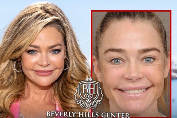 denise richards before and after pics are giving her surgeons business a lift 69c1c620dcd51
