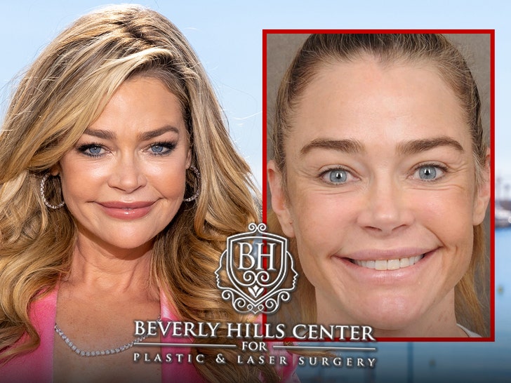 denise richards before and after pics are giving her surgeons business a lift 69c1c620dcd51