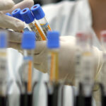 un studiu dezvaluie cele 37 de proteine din sangele centenarilor legate de o viata mai lunga si mai sanatoasa 69aed3ee24b39